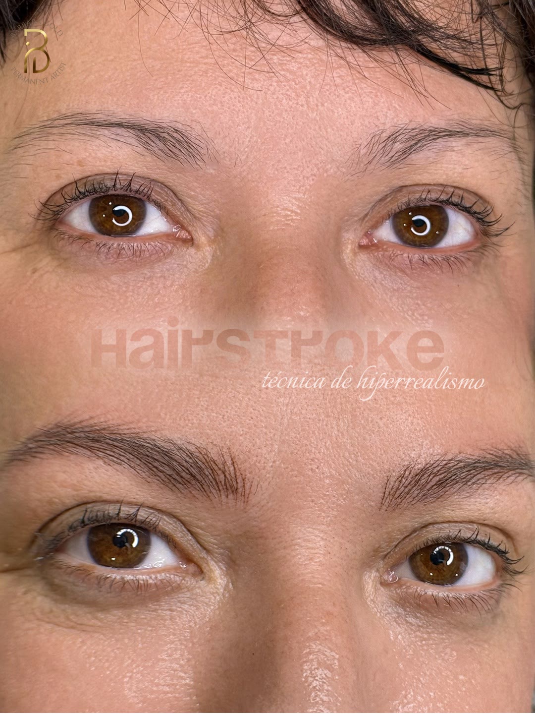 Corrección de una micropigmentación anterior