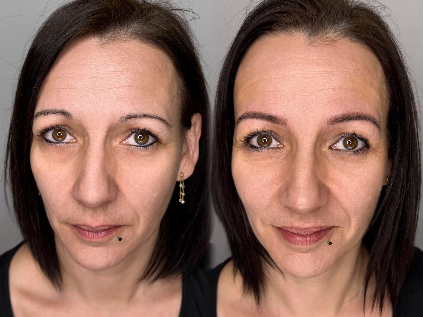 Antes y después de un diseño de cejas personalizado