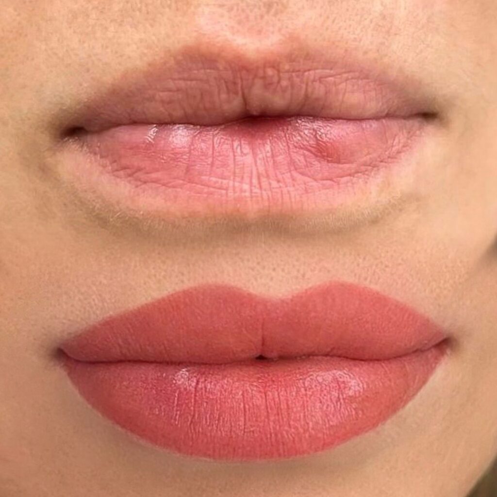 Labios antes y después, color uniforme y contorno definido