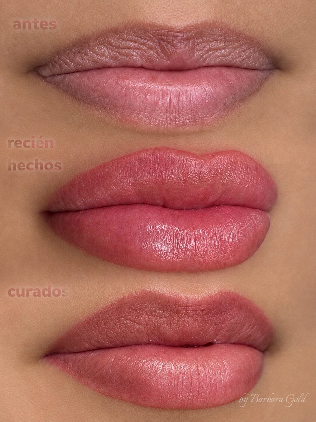 Labios antes, recién hechos y curados